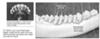 Teeth from a 2 1/2 Year old moose - Photo by Craig Bihrle